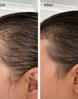 Before and after comparison of hair growth on a person's head. Before and after hair growth transformation using rosemary hair oil