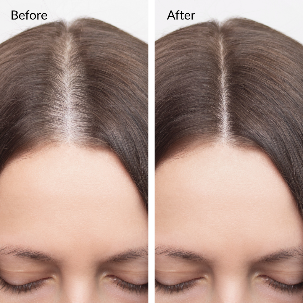 Rosemary Hair Oil Intense Growth Syrup 100ml