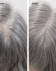 Before and after comparison of gray hair treatment on a person's head. Before and after hair growth transformation using rosemary hair oil
